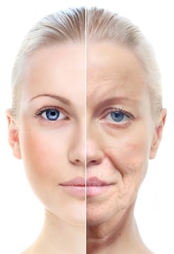 ageing skin